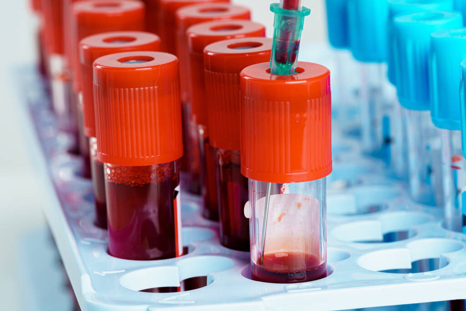 Blood Group Examination